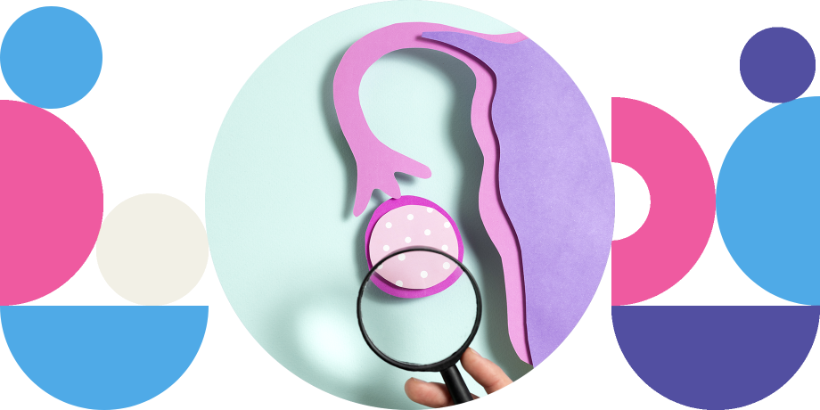 Polikistik Over Sendromu (PKOS) Nedir?