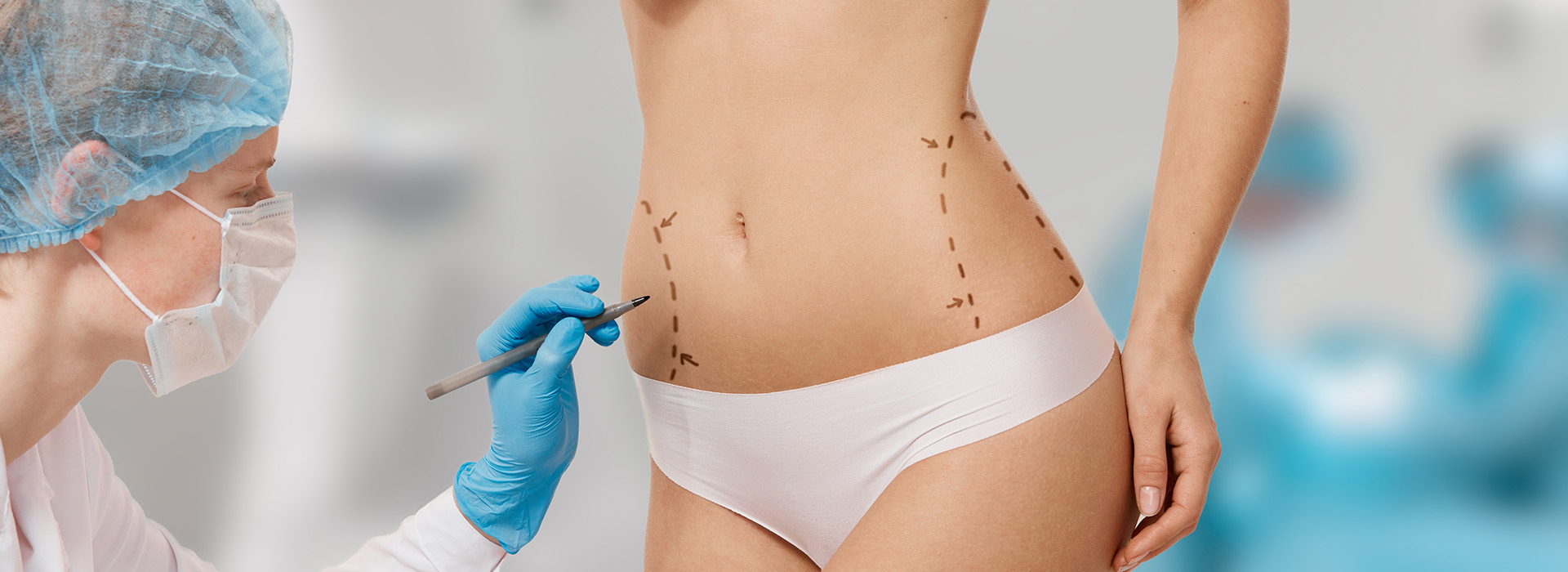 liposuction